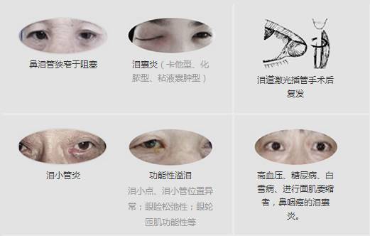 12月17日，普瑞集團(tuán)淚道專(zhuān)家來(lái)疆親診，預(yù)約請(qǐng)速！